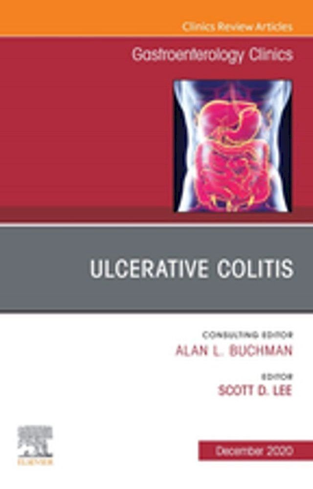  Ulcerative Colitis, An Issue of Gastroenterology Clinics of North America, E-Book(Kobo/電子書)