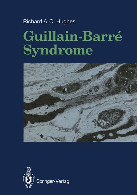 Guillain-Barré Syndrome(Kobo/電子書)