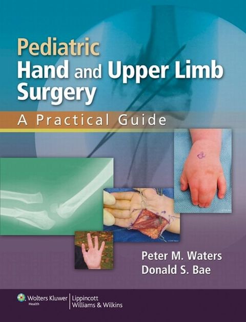 Pediatric Hand and Upper Limb Surgery(Kobo/電子書)