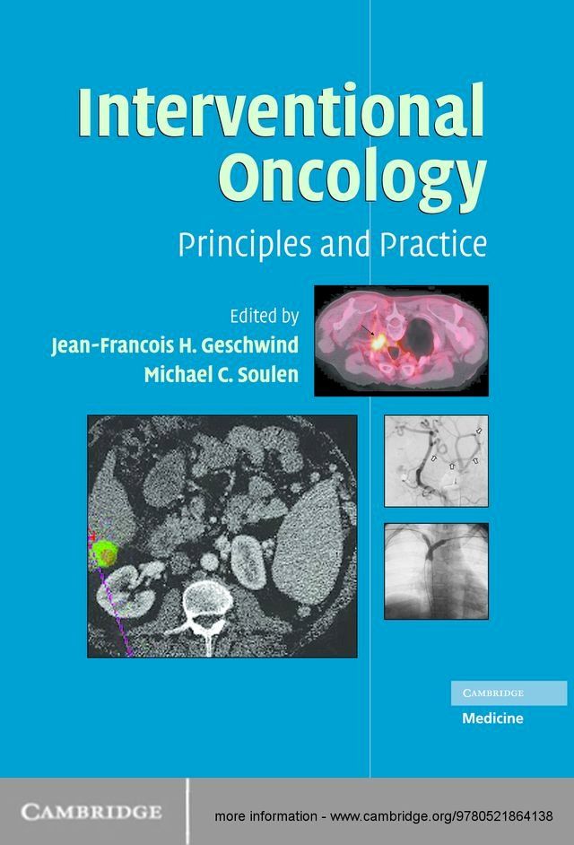  Interventional Oncology(Kobo/電子書)