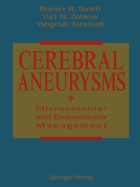 Cerebral Aneurysms(Kobo/電子書)