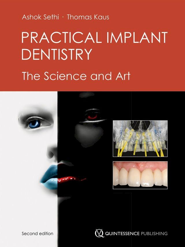  Practical Implant Dentistry(Kobo/電子書)