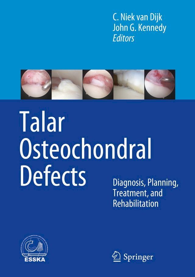  Talar Osteochondral Defects(Kobo/電子書)