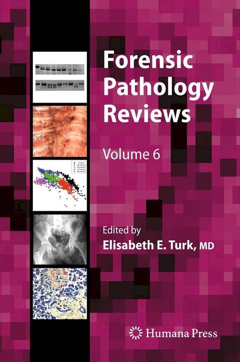 Forensic Pathology Reviews(Kobo/電子書)