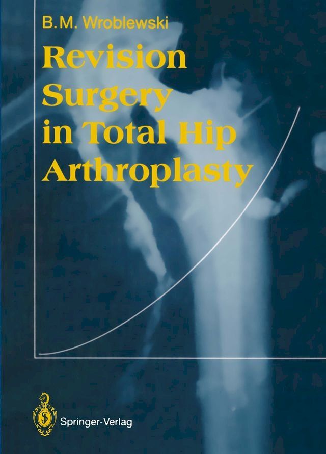  Revision Surgery in Total Hip Arthroplasty(Kobo/電子書)