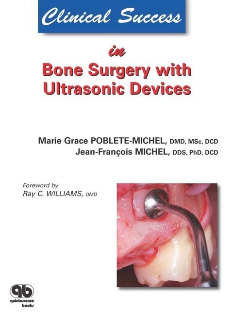 Clinical Success in Bone Surgery with Ultrasonic Devices(Kobo/電子書)