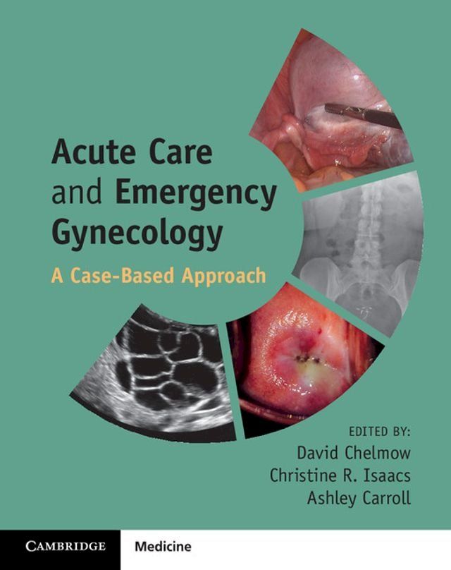  Acute Care and Emergency Gynecology(Kobo/電子書)