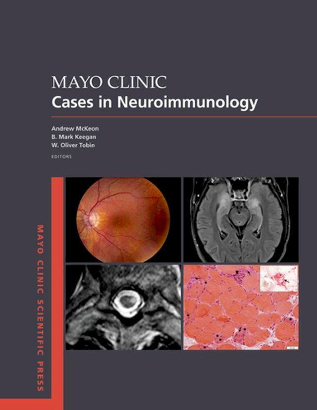  Mayo Clinic Cases in Neuroimmunology(Kobo/電子書)