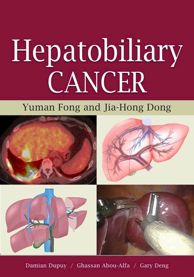  Hepatobiliary Cancer(Kobo/電子書)