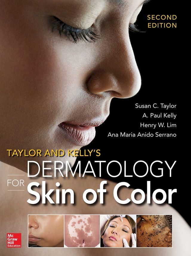  Taylor and Kelly's Dermatology for Skin of Color 2/E(Kobo/電子書)