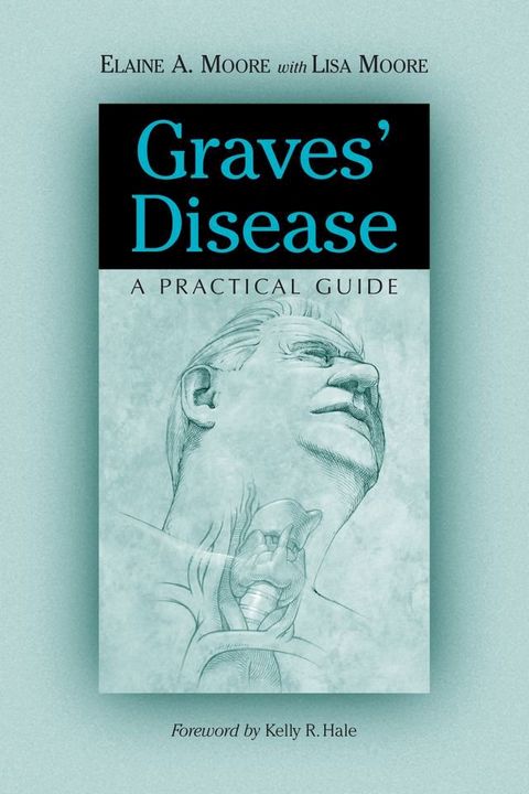 Graves' Disease: A Practical Guide(Kobo/電子書)