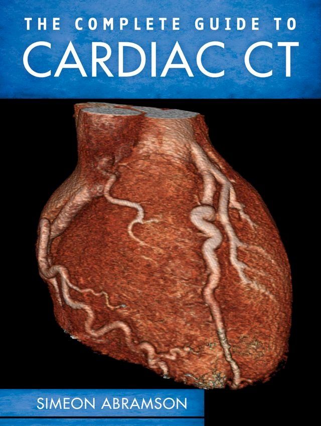  The Complete Guide To Cardiac CT (PB)(Kobo/電子書)