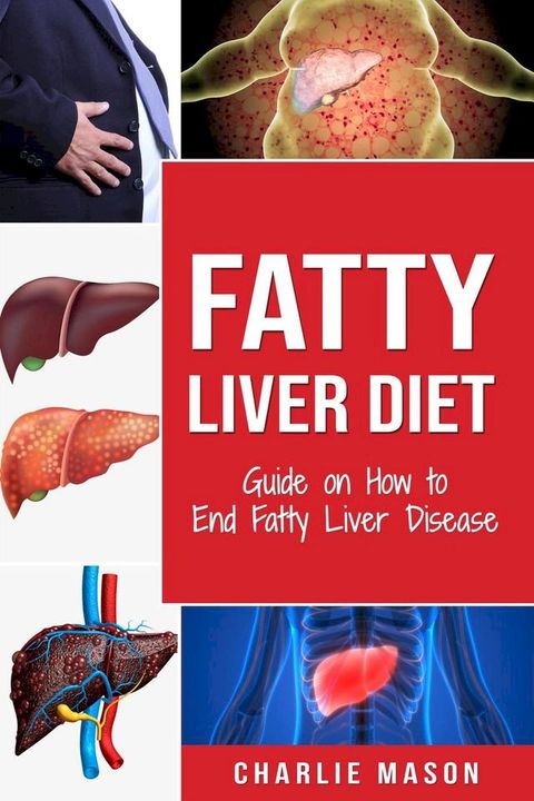 Fatty Liver Diet: Guide on How to End Fatty Liver Disease(Kobo/電子書)