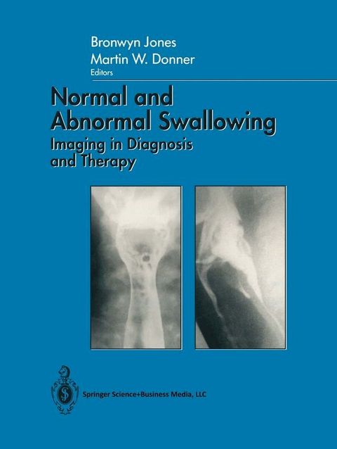 Normal and Abnormal Swallowing(Kobo/電子書)