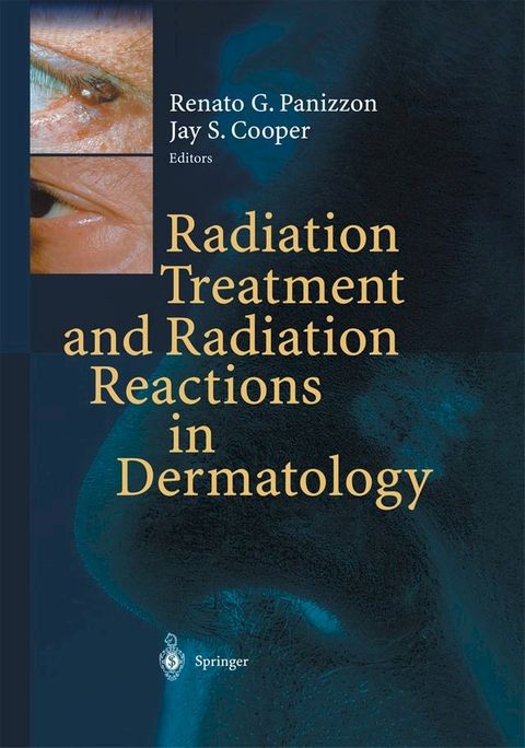 Radiation Treatment and Radiation Reactions in Dermatology(Kobo/電子書)