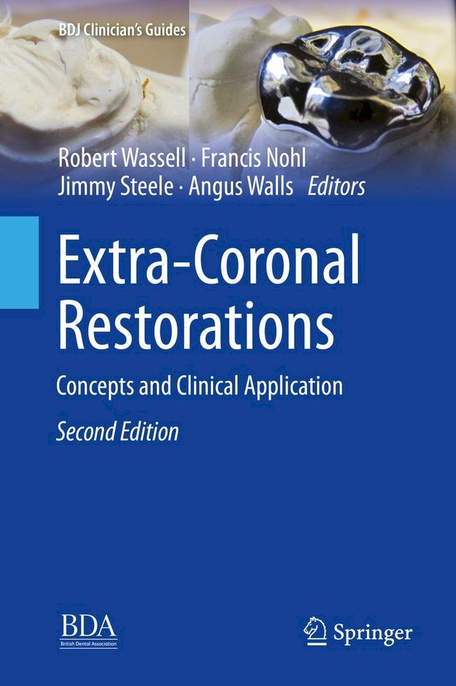  Extra-Coronal Restorations(Kobo/電子書)