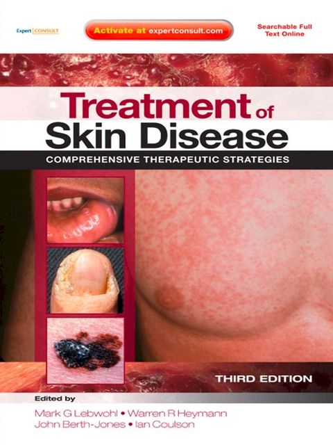 Treatment of Skin Disease(Kobo/電子書)