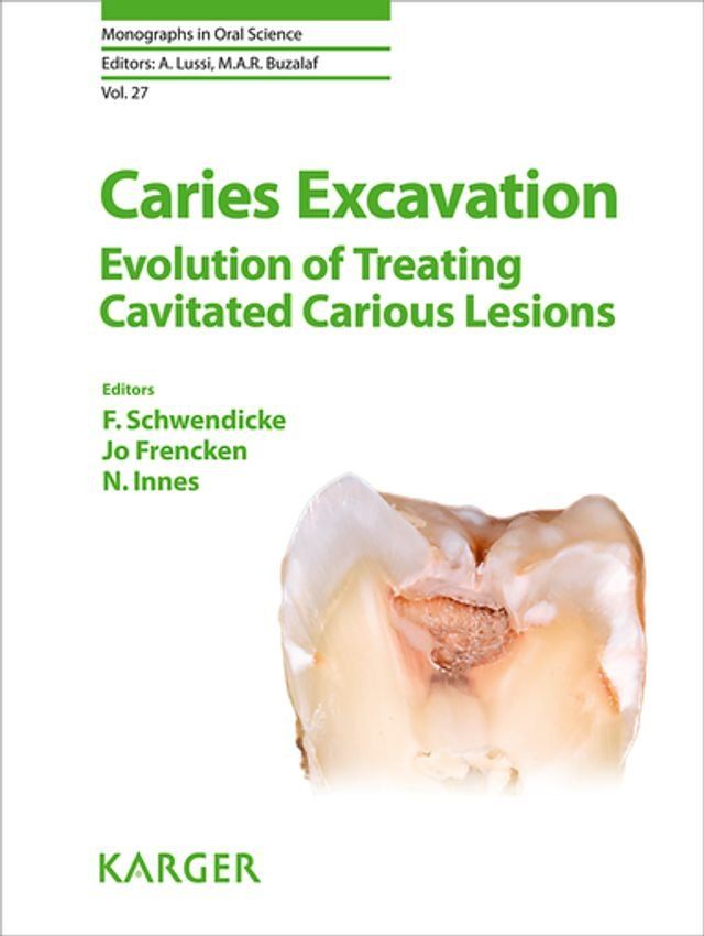  Caries Excavation: Evolution of Treating Cavitated Carious Lesions(Kobo/電子書)