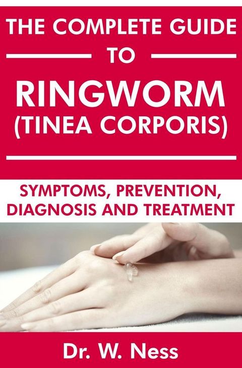 The Complete Guide to Ringworm (Tinea Corporis): Symptoms, Prevention, Diagnosis and Treatment(Kobo/電子書)