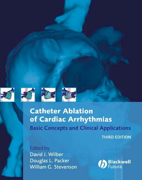 Catheter Ablation of Cardiac Arrhythmias(Kobo/電子書)