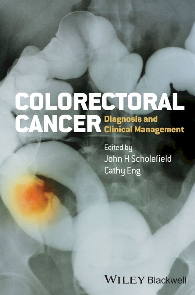  Colorectal Cancer(Kobo/電子書)