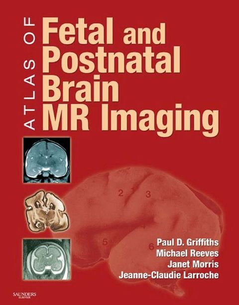 Atlas of Fetal and Infant Brain MR(Kobo/電子書)