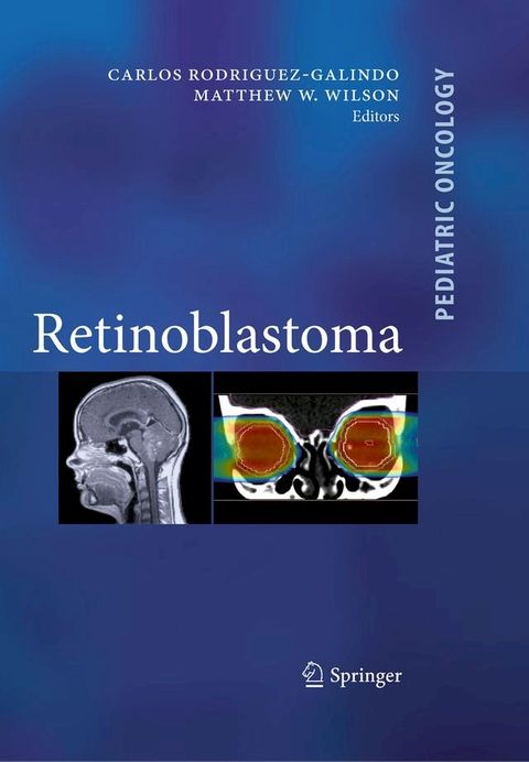 Retinoblastoma(Kobo/電子書)