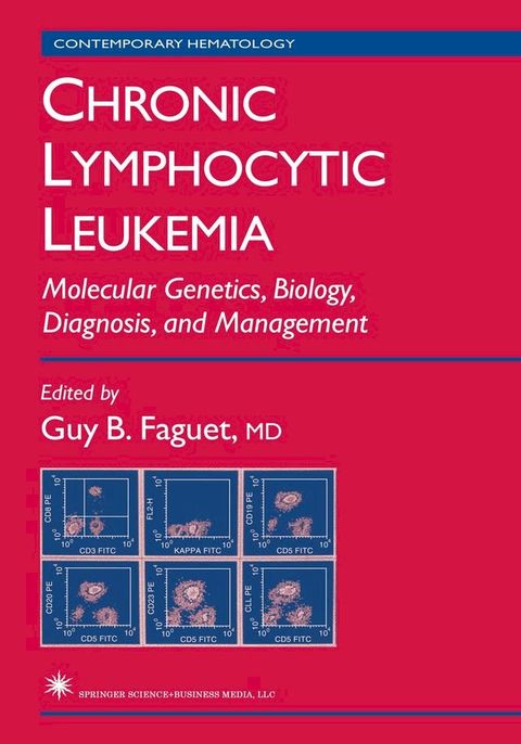 Chronic Lymphocytic Leukemia(Kobo/電子書)