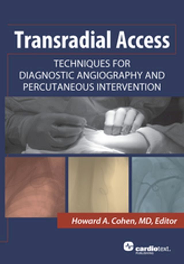  Transradial Access: Techniques for Diagnostic Angiography and Percutaneous Intervention(Kobo/電子書)