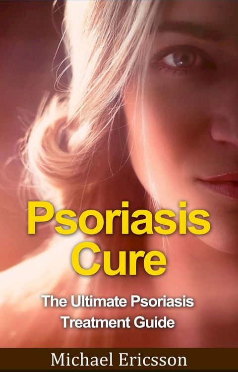 Psoriasis Cure: The Ultimate Psoriasis Treatment Guide(Kobo/電子書)