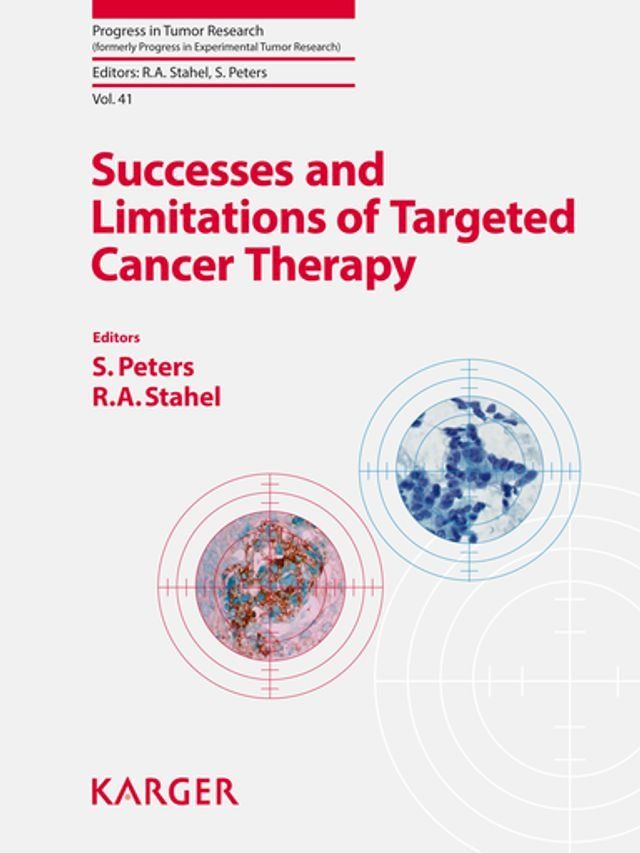  Successes and Limitations of Targeted Cancer Therapy(Kobo/電子書)