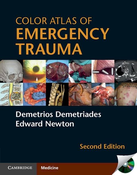 Color Atlas of Emergency Trauma(Kobo/電子書)