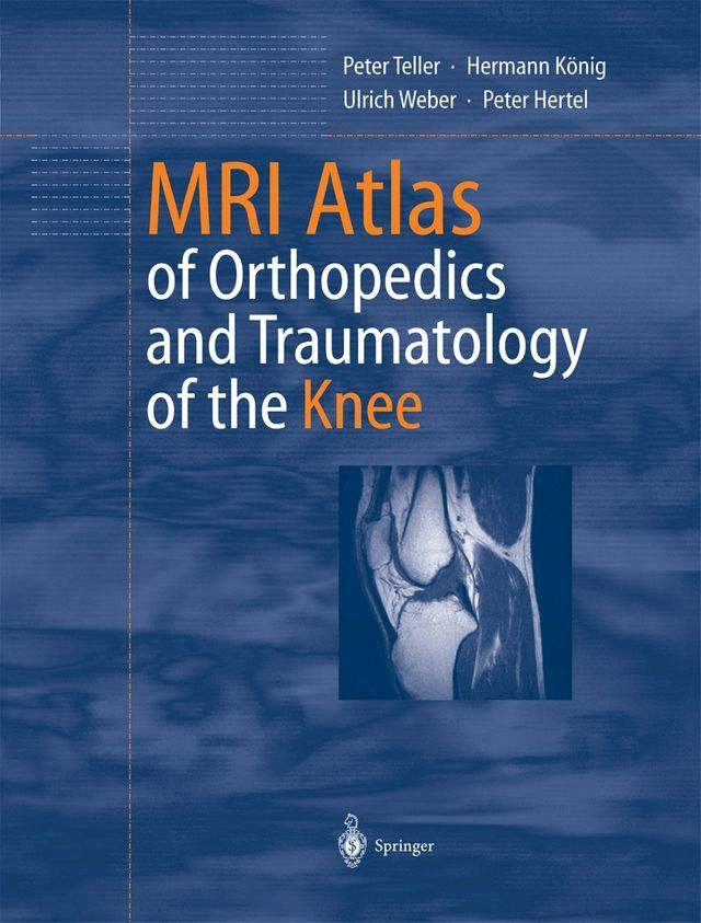  MRI Atlas of Orthopedics and Traumatology of the Knee(Kobo/電子書)