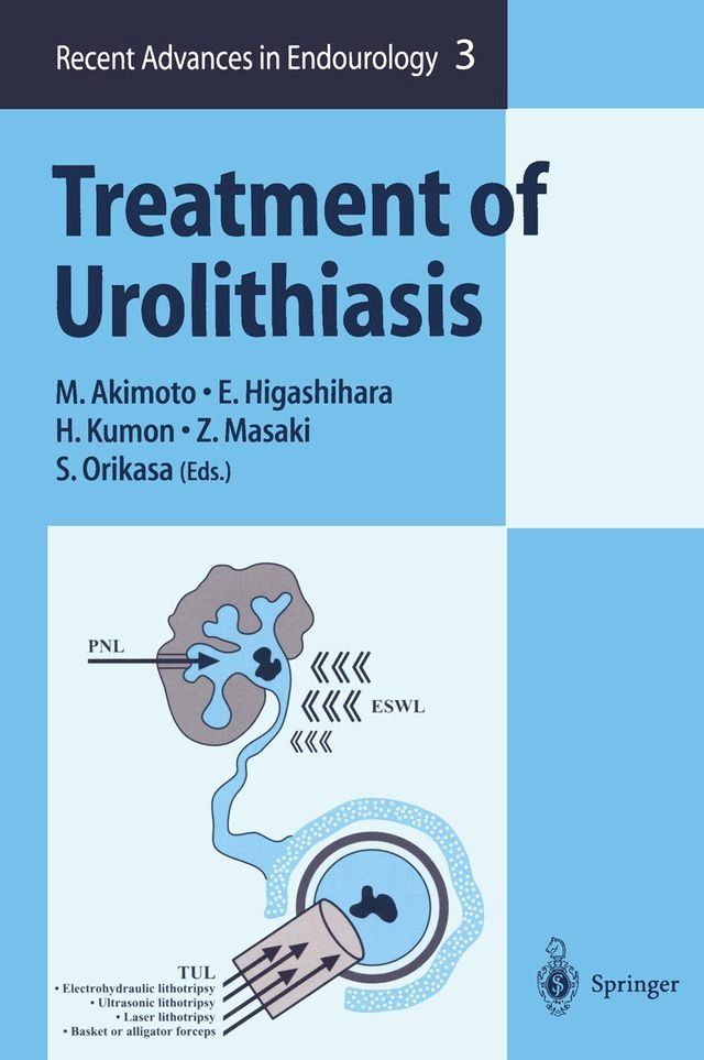  Treatment of Urolithiasis(Kobo/電子書)