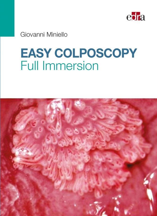  Easy Colposcopy(Kobo/電子書)