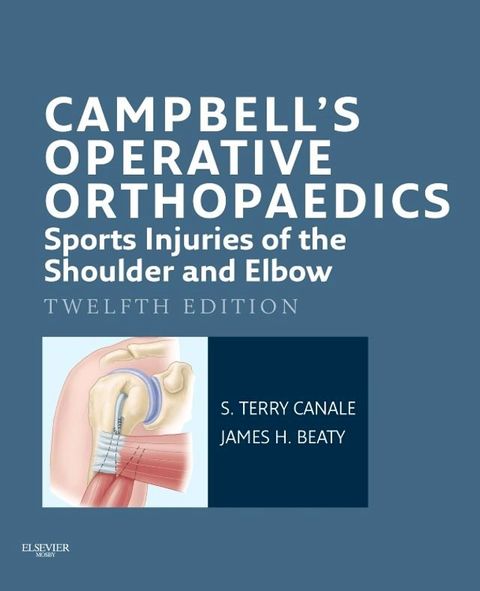 Campbell's Operative Orthopaedics: Sports Injuries of the Shoulder and Elbow E-Book(Kobo/電子書)