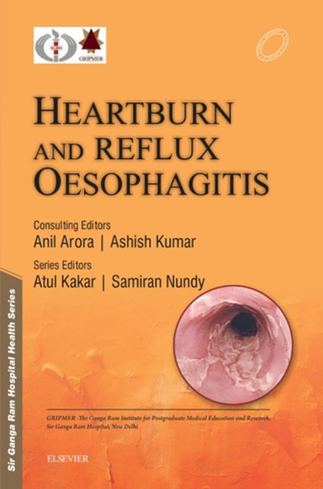  Sir Ganga Ram Hospital Health Series: Heartburn and Reflux Oesophagitis - e-book(Kobo/電子書)