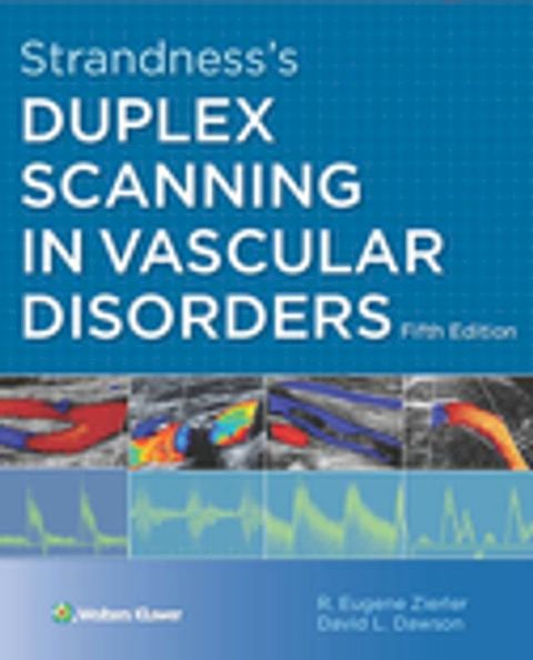 Strandness's Duplex Scanning in Vascular Disorders(Kobo/電子書)