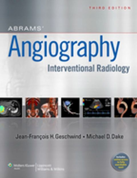 Abrams' Angiography(Kobo/電子書)