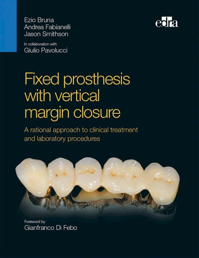  Fixed prosthesis with vertical margin closure(Kobo/電子書)