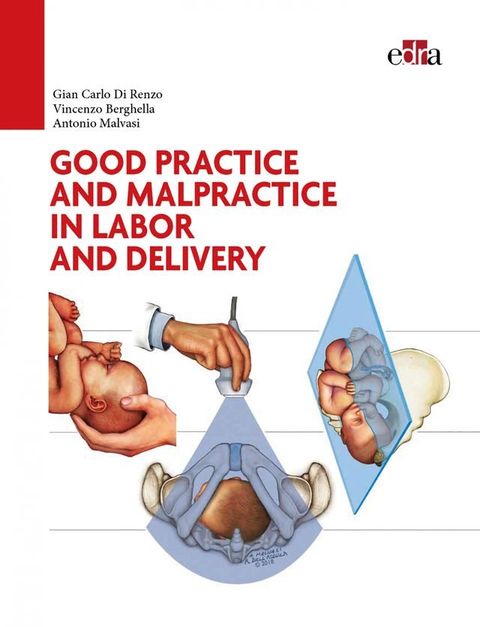 Good practice and malpractice in labor and delivery(Kobo/電子書)