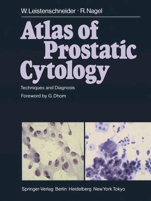  Atlas of Prostatic Cytology(Kobo/電子書)