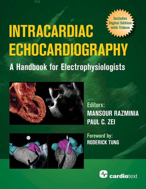 Intracardiac Echocardiography: A Handbook for Electrophysiologists(Kobo/電子書)