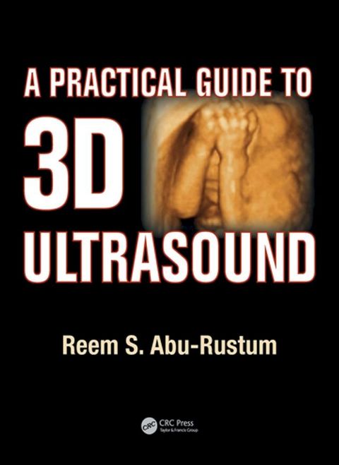 A Practical Guide to 3D Ultrasound(Kobo/電子書)