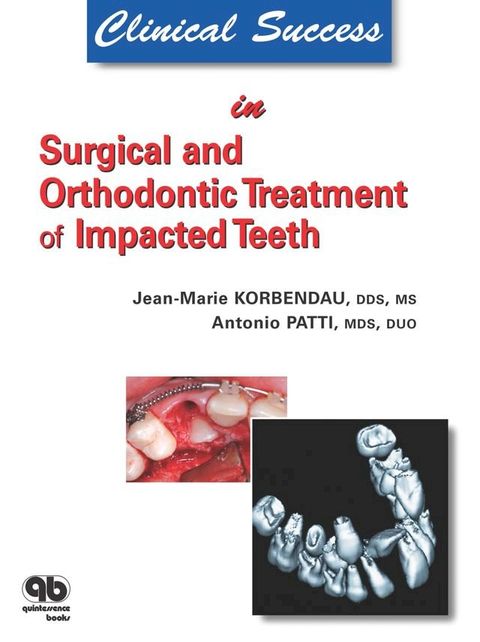 Clinical Success in Surgical and Orthodontic Treatment of Impacted Teeth(Kobo/電子書)