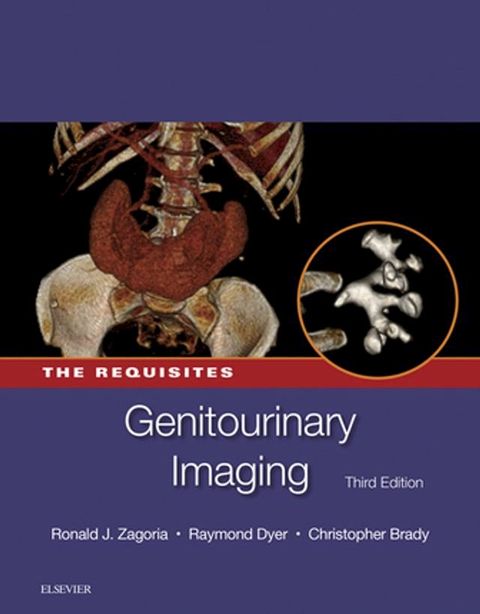 Genitourinary Imaging: The Requisites E-Book(Kobo/電子書)