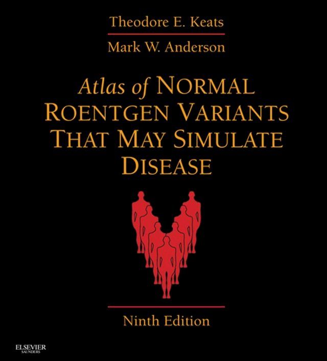  Atlas of Normal Roentgen Variants That May Simulate Disease(Kobo/電子書)