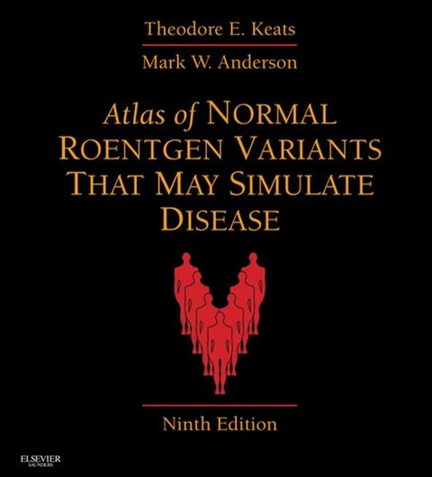 Atlas of Normal Roentgen Variants That May Simulate Disease(Kobo/電子書)