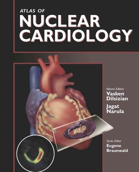 Atlas of Nuclear Cardiology(Kobo/電子書)