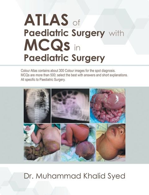 Atlas of Paediatric Surgery with Mcqs in Paediatric Surgery(Kobo/電子書)